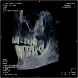 Queen Paroh (BCE1504-1483) Khat-shepset x-ray